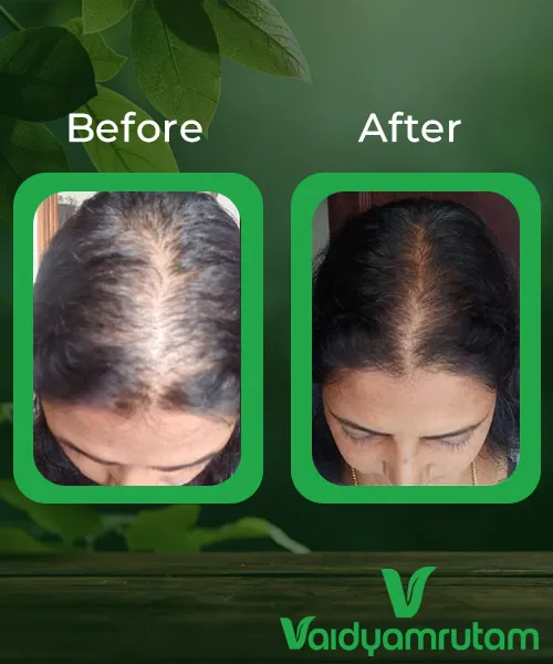 Before After Result 1
